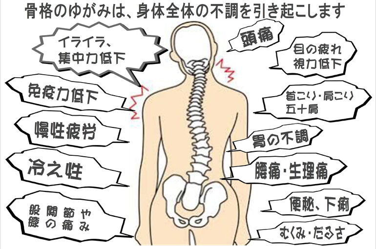 骨格のゆがみ①_01